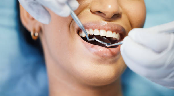 Best Emergency Dental Care for Broken or Chipped Teeth in Lykens, PA